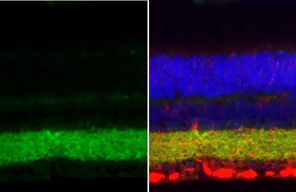 VIAAT/SLC32A1/VGAT Antibody