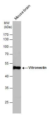 Vitronectin Antibody