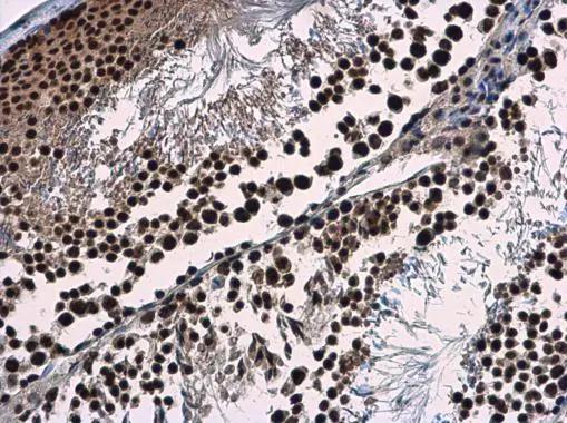 WDR62 Antibody