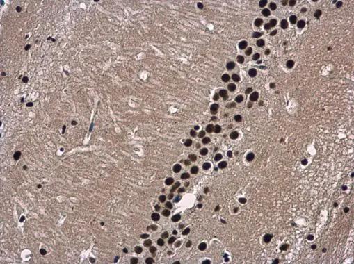 WDR62 Antibody