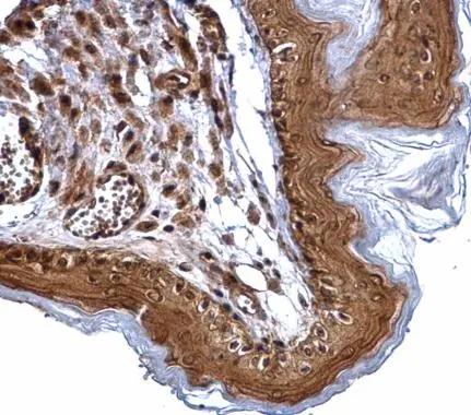 XPD Antibody