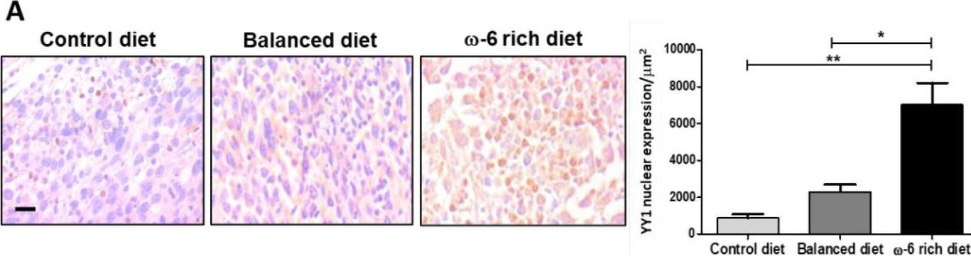 YY1 Antibody - BSA Free
