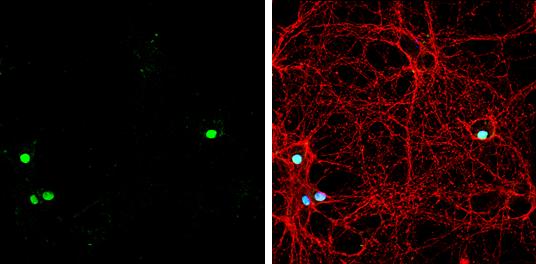 ZBTB20 Antibody - BSA Free