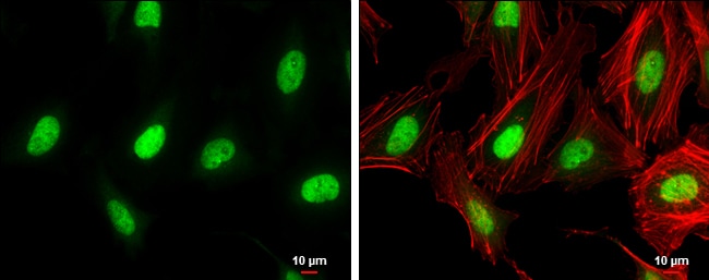 ZEB1 Antibody