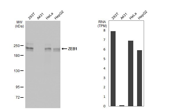 ZEB1 Antibody