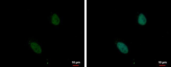 ZNF124 Antibody - BSA Free