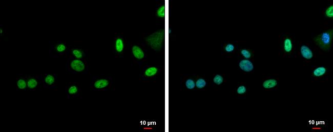 ZNF181 Antibody - BSA Free
