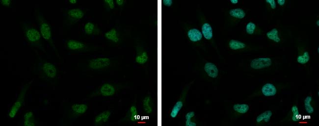 ZNF189 Antibody - BSA Free