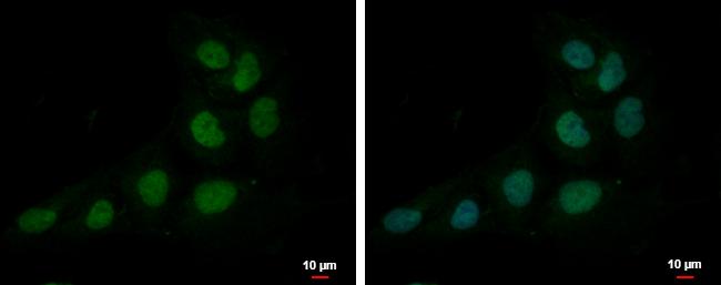 ZNF326 Antibody