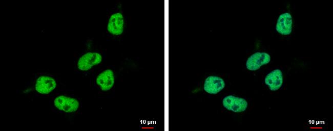 ZNF329 Antibody - BSA Free