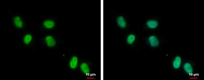 ZNF329 Antibody - BSA Free