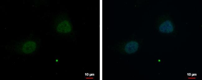 ZNF384 Antibody