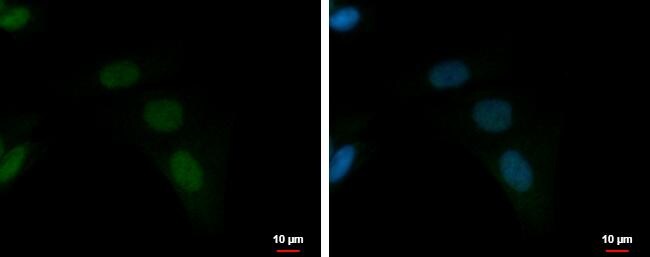 ZNF406 Antibody - BSA Free