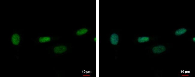 ZNF419A Antibody
