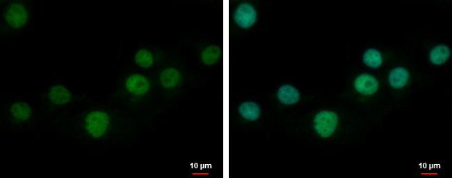 ZNF501 Antibody - BSA Free