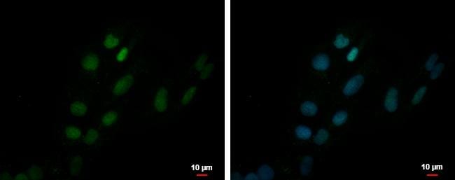ZNF550 Antibody - BSA Free