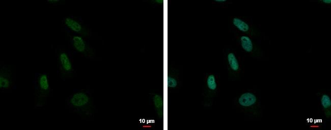 ZNF587 Antibody