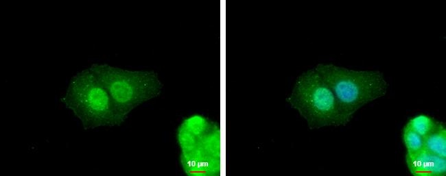 ZNF703 Antibody - BSA Free
