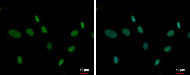 ZNF74 Antibody - BSA Free