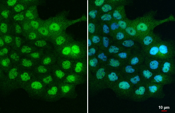 YF5 Antibody