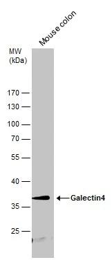 Galectin-4 Antibody - BSA Free