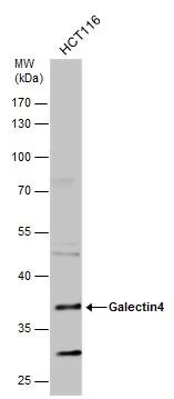 Galectin-4 Antibody - BSA Free