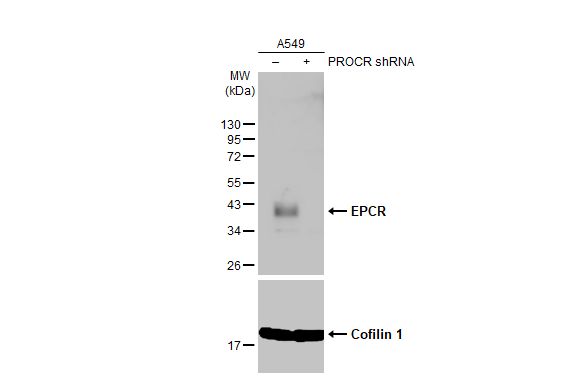 EPCR Antibody - BSA Free