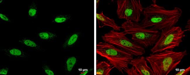 OCT1 Antibody