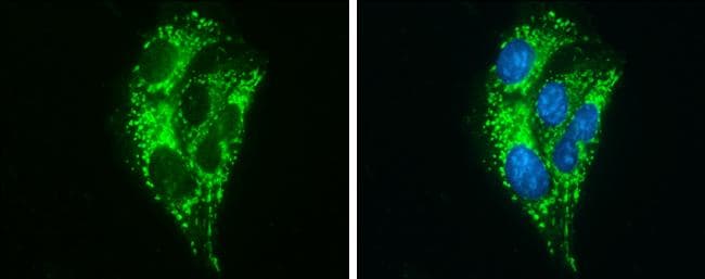 ABAT Antibody - BSA Free