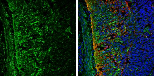 ABAT Antibody - BSA Free