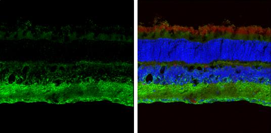 ABAT Antibody - BSA Free