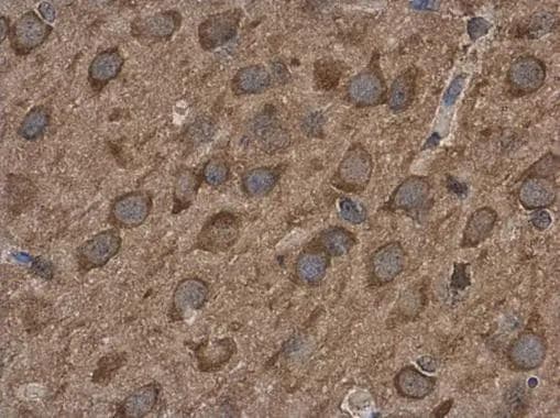 ABAT Antibody - BSA Free