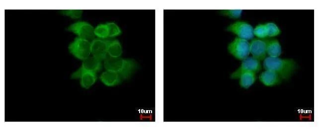 ABCD4 Antibody - BSA Free