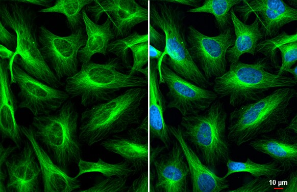 alpha Tubulin 4a Antibody