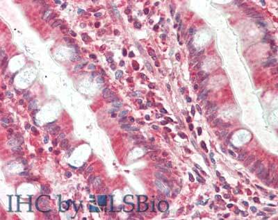 TIMP-4 Antibody (9:4-7)