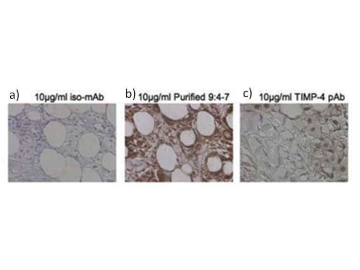 TIMP-4 Antibody (9:4-7)
