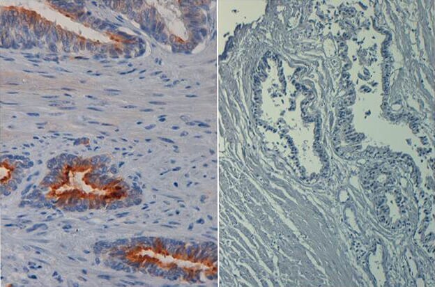 AKT1 [p Ser473] Antibody (17F6.B11) [Biotin]