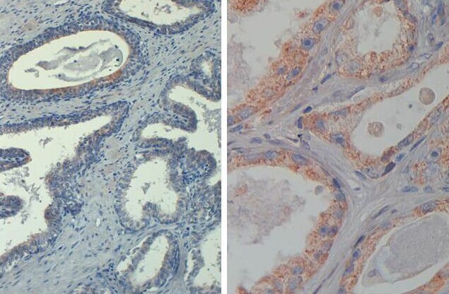 AKT1 [p Thr308] Antibody (18F3.H11) [Biotin]
