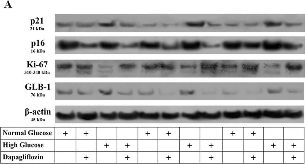 Ki67/MKI67 Antibody (8D5) - BSA Free
