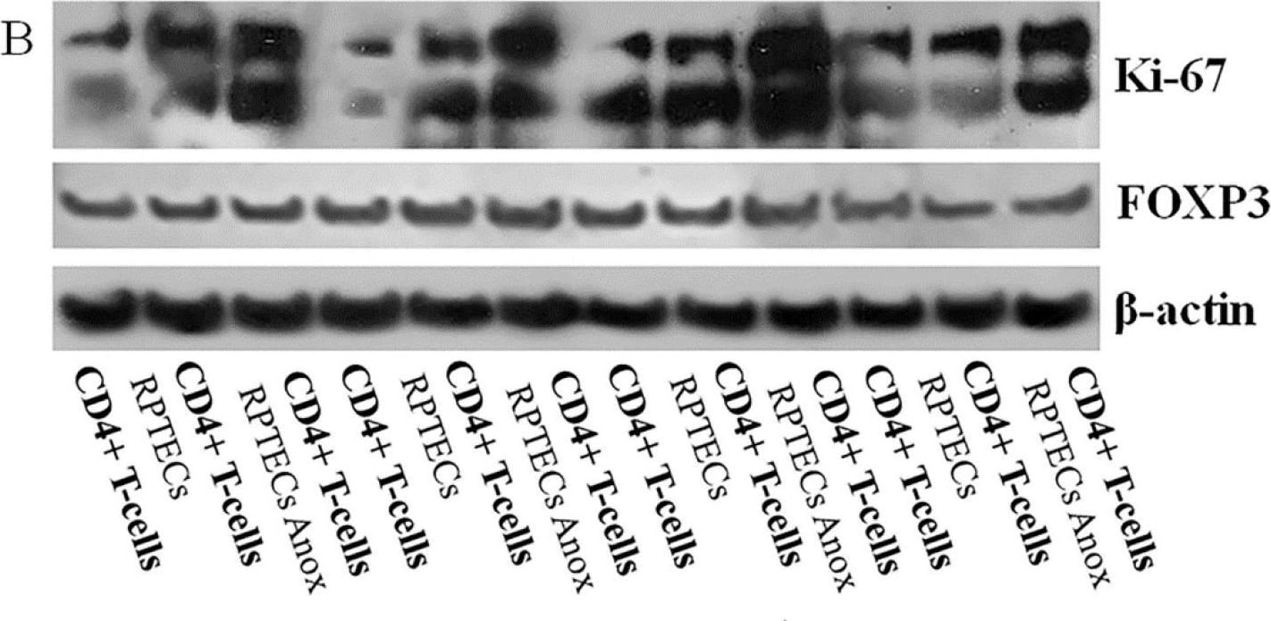 Ki67/MKI67 Antibody (8D5) - BSA Free