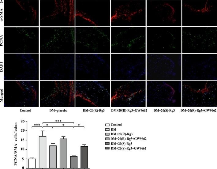 alpha-Smooth Muscle Actin Antibody (4A4) - BSA Free
