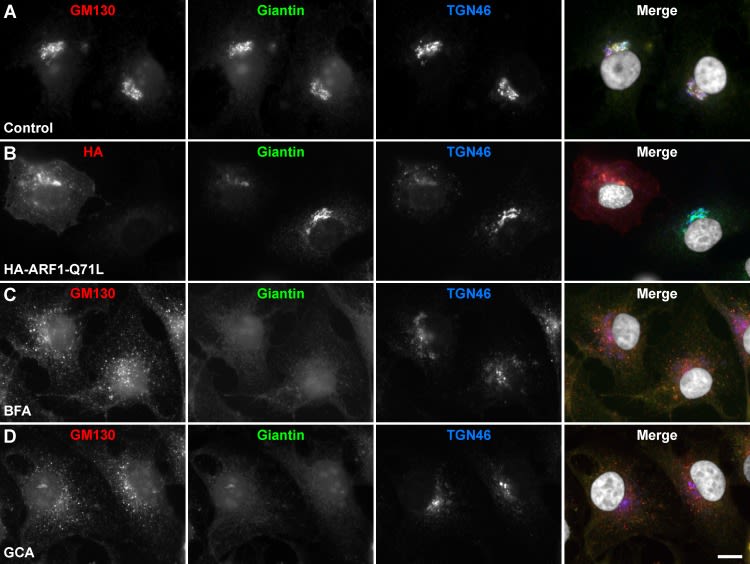 GOLGB1/Giantin Antibody - BSA Free