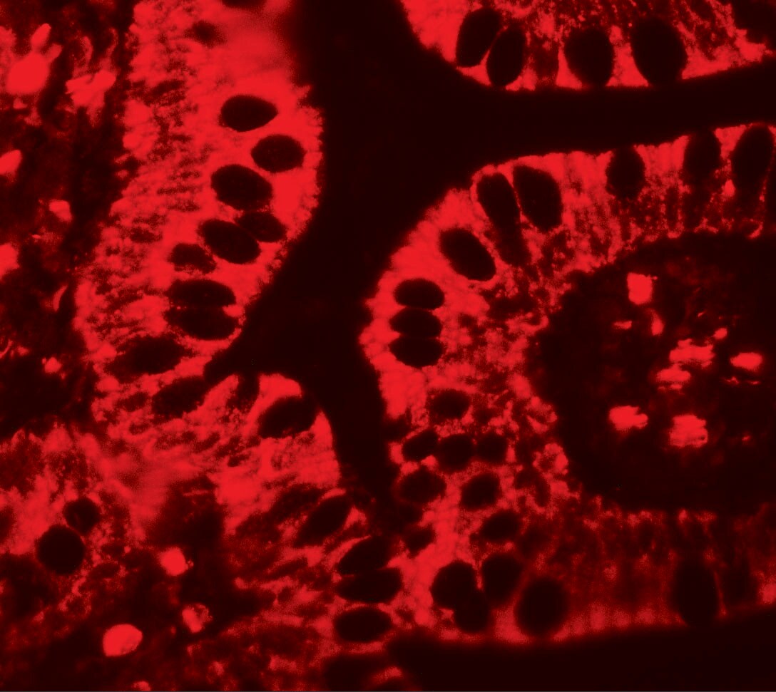 SHISA3 Antibody - BSA Free