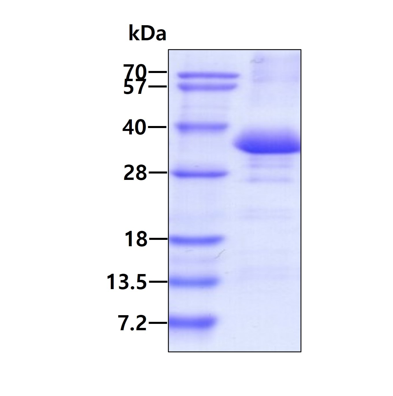 Recombinant Human Phospholipid Scramblase 1/PLSCR1 His Protein