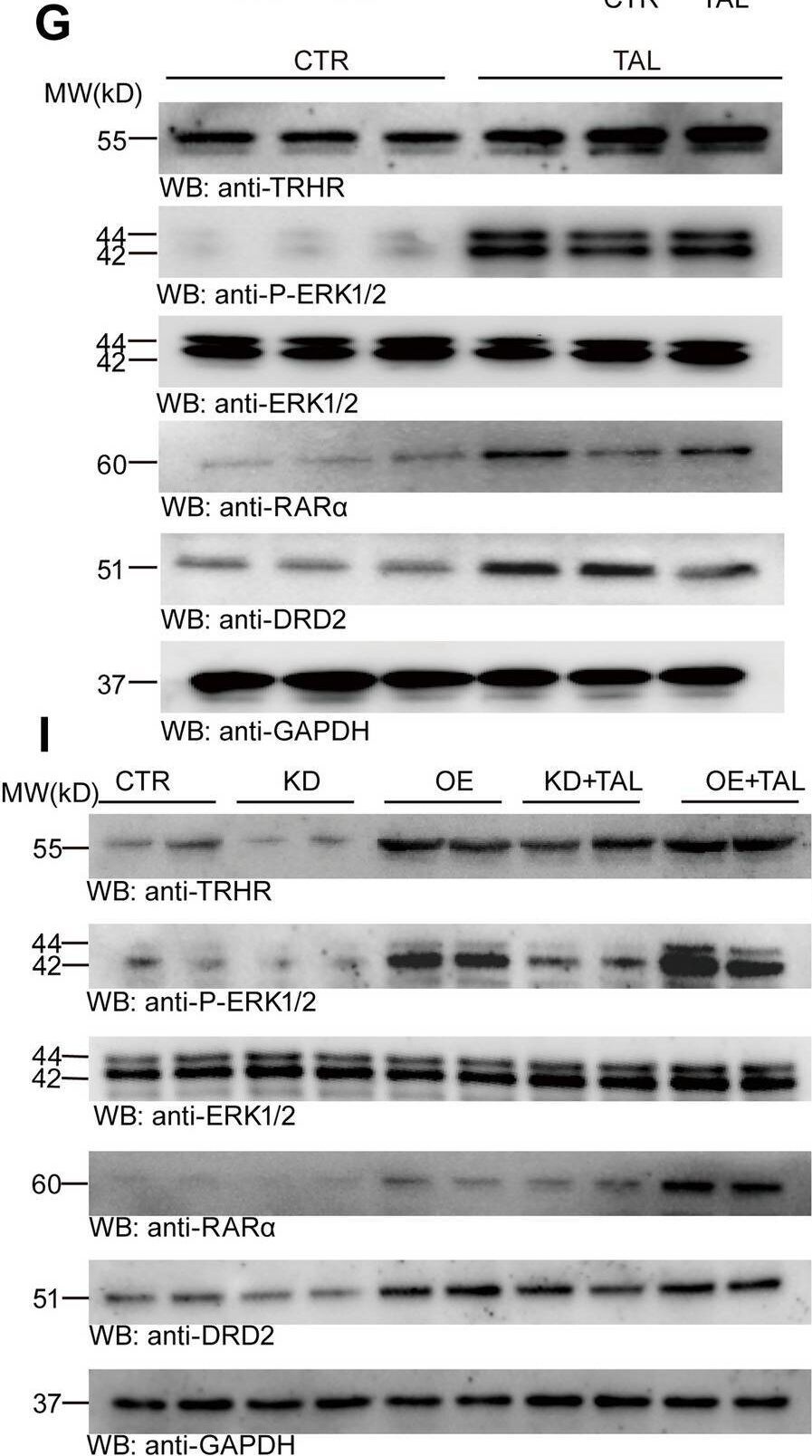 TRHR Antibody - BSA Free