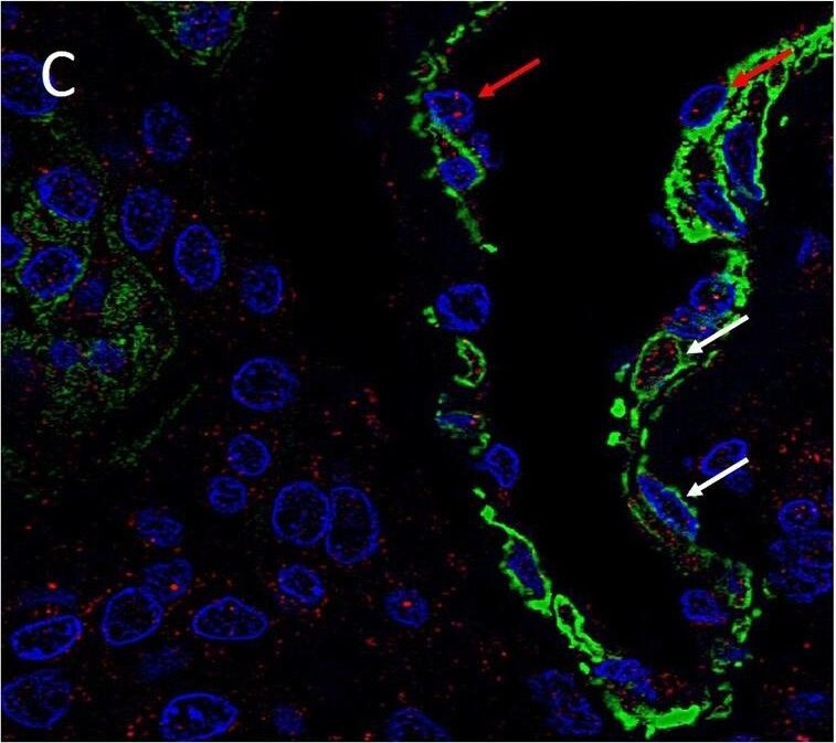 KLF4 Antibody