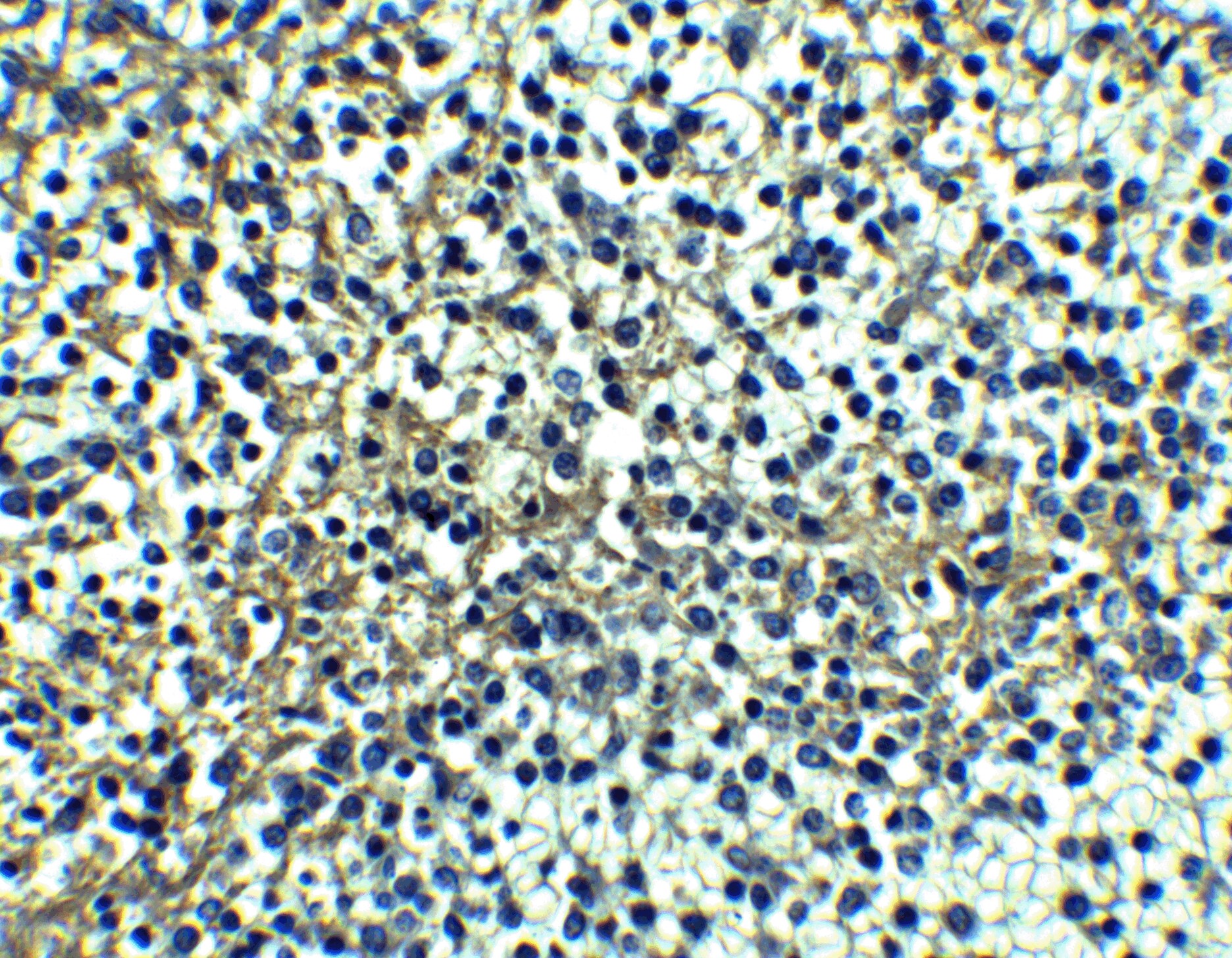 TRAILR1/TNFRSF10A Antibody - BSA Free