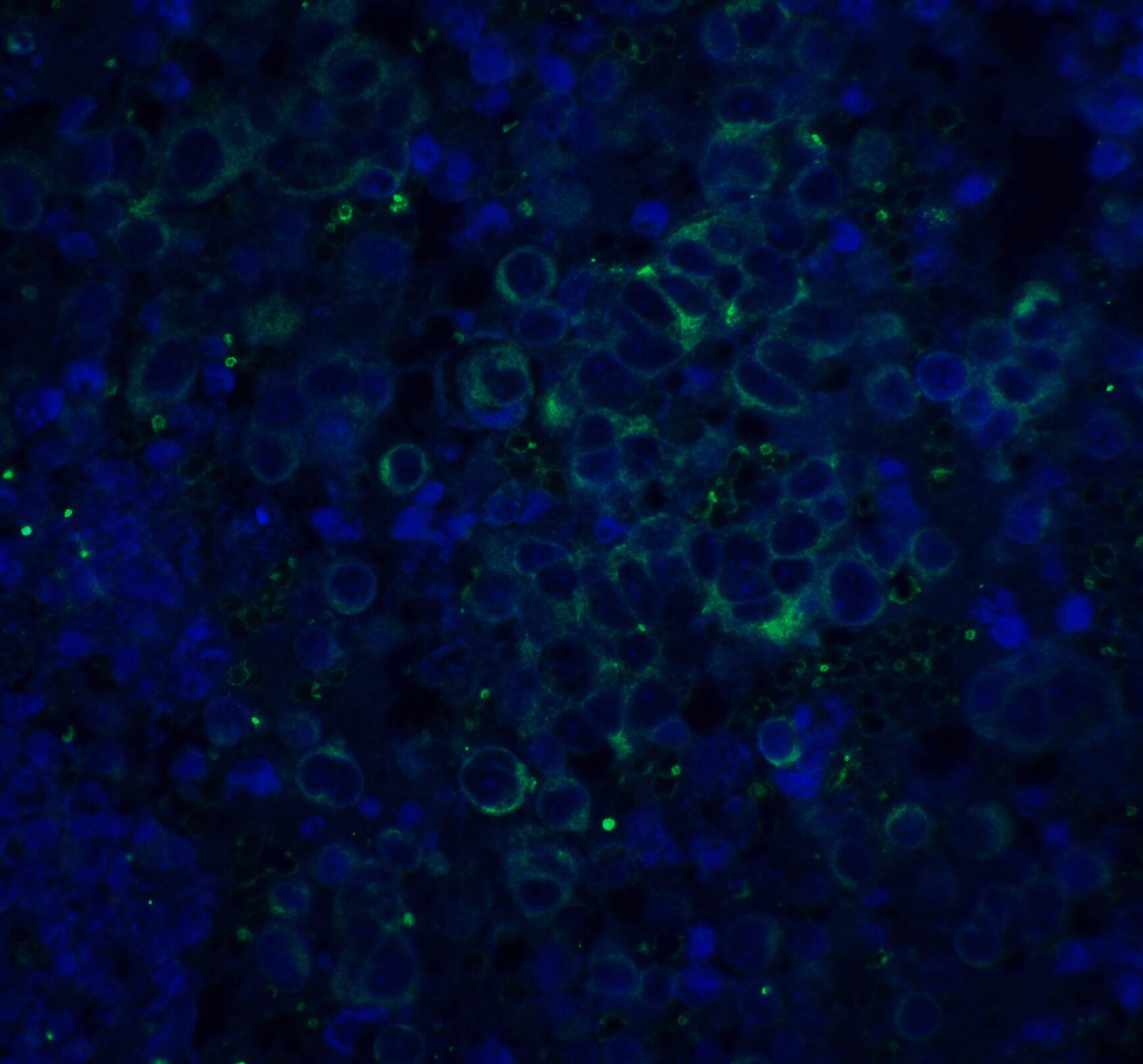 beta Amyloid Antibody - BSA Free