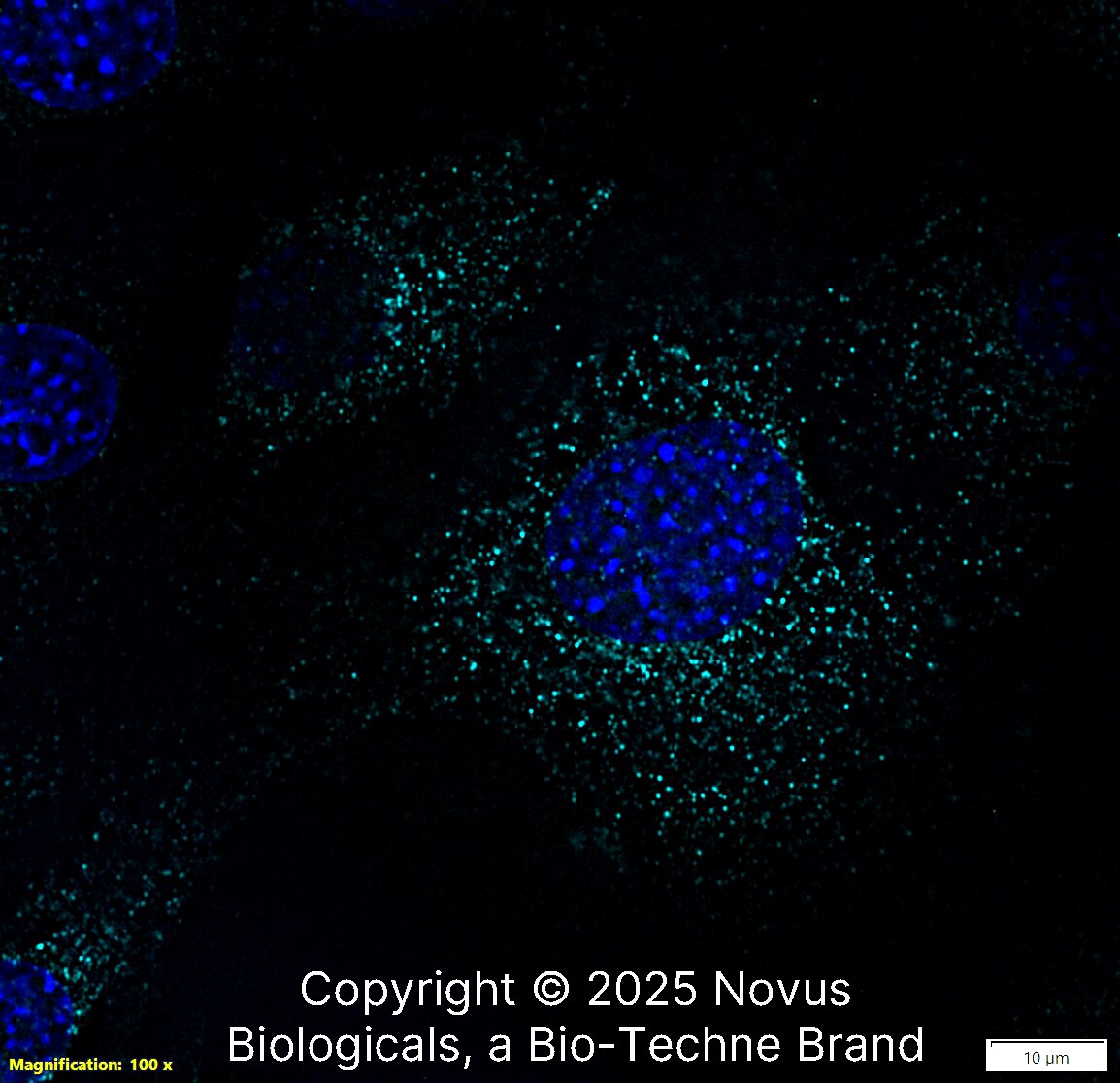 LAMP-1/CD107a Antibody (H4A3) [Alexa Fluor® 647]