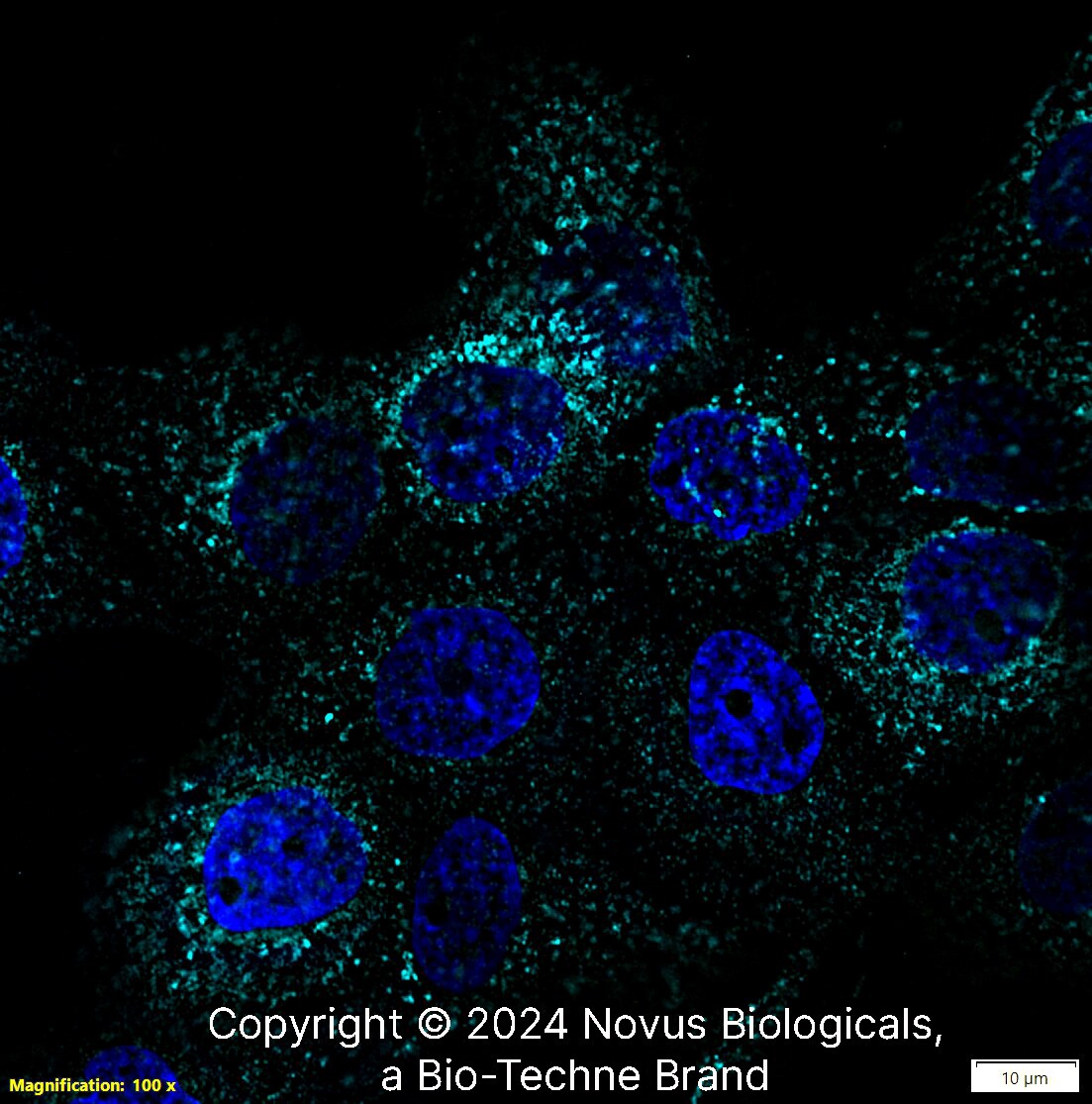 LAMP-1/CD107a Antibody (H4A3) [Alexa Fluor® 647]